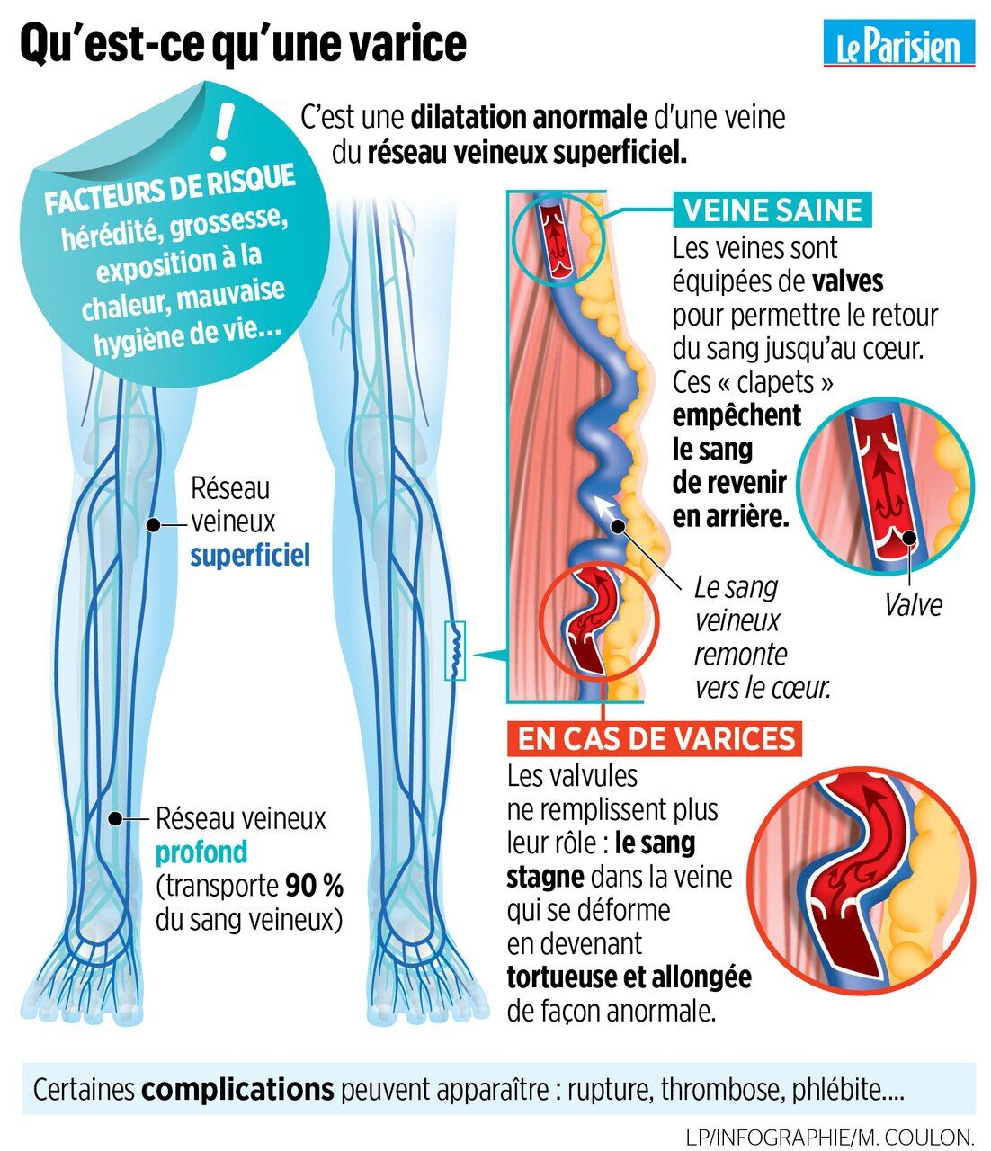 découvrez comment la grossesse peut entraîner des varices et apprenez des astuces pour prévenir et soulager ce problème courant. informez-vous sur les traitements disponibles et les conseils pratiques pour garder vos jambes en bonne santé durant cette période.